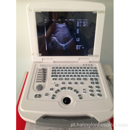 Exibir LED Vascular Laptop Ultrassom Scanner Preço